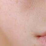 Why Your Skin Stays Dehydrated Even After Moisturizing