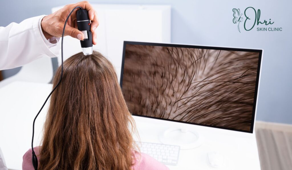 Best Doctors For Hair Loss Treatment In Delhi