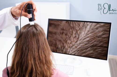 Best Doctors For Hair Loss Treatment In Delhi