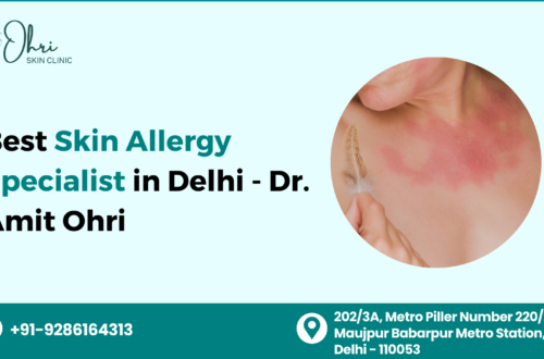 Best Skin Allergy Specialist in Delhi | Dr. Amit Ohri
