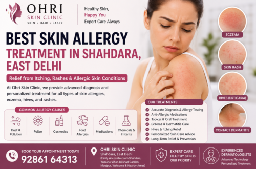 Best Skin Allergy Treatment in Shahdara, East Delhi by expert dermatologists at Ohri Skin Clinic for eczema, skin rashes, itching, contact dermatitis, and allergic skin conditions.